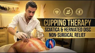 Professional Cupping Therapy for Chronic Pain Relief 🩺