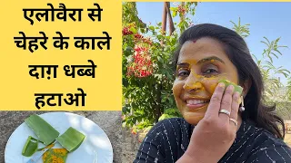 Aloe Vera Benefits - Facial for Summer