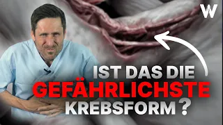 Bauchspeicheldrüsenkrebs: Wichtige Anzeichen! Früherkennung & Therapie bei Diagnose Pankreaskarzinom