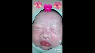 Khoảnh khắc em bé sơ sinh dễ thương siêu cute vừa mới sinh nặng 3700 gram