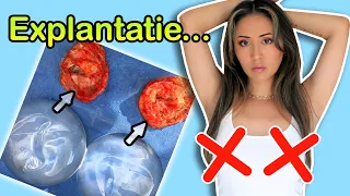 Moordtieten & SPIJT VAN MIJN BORSTVERGROTING 😥 Explantatie & Operatie ❤️ ShelingBeauty