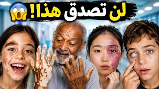 أغرب 7 حالات طبية لن تصدق وجودها🔥😱
