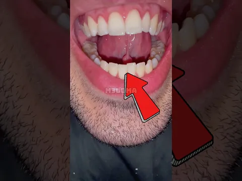 كيف يبصق الأشخاص هكذا؟!