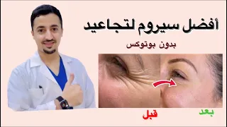 لإزالة التجاعيد وشد الوجه بأفضل سيروم بالصيدلية وبدون بوتوكس
