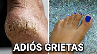 Pedicure en casa PASO A PASO 👣 | Tutorial para talones suaves y uñas limpias ✨