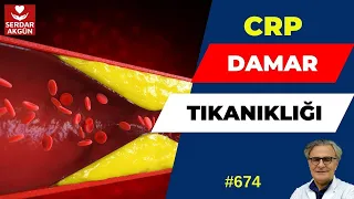 674. CRP Yüksekliği, Enfeksiyon, Damar Tıkanıklığı, Sağlık, Prof.Dr.Serdar Akgün, Tıp Videoları