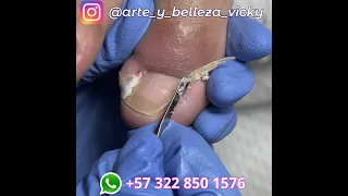 Excelente resultado al hacer cortes preventivos - arte y belleza vicky