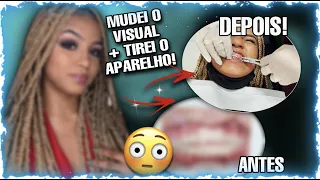 MUDEI O VISUAL + TIREI O APARELHO DEPOIS DE 6 ANOS!