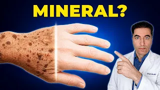 Staračke mrlje nakon 50? Nedostaje Vam OVAJ mineral!
