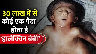 बरेली के अस्पताल में हुआ ऐसी बच्ची का जन्म कि डॉक्टर भी दंग रह गये I INDE News