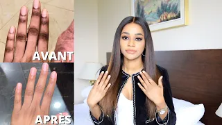 LA SOLUTION CONTRE LES QUINTOS, PIEDS, COUDES ET GENOUX FONCÉS -  HYPERPIGMENTATION⎮Maggy Kloset