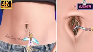 [ASMR]Cool and clean! Belly stone removal, belly button removal animation asmr/4k/ 배꼽돌 제거 애니메이션 asmr