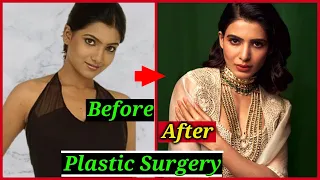 Shocking Plastic Surgery of South Indian Actresses | Samantha Akkineni, Kajal Aggarwal, Anushka