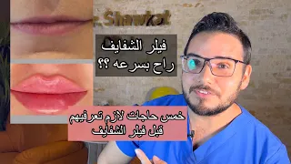 فيلر الشفايف واهم خمس نصايح قبل الحقن