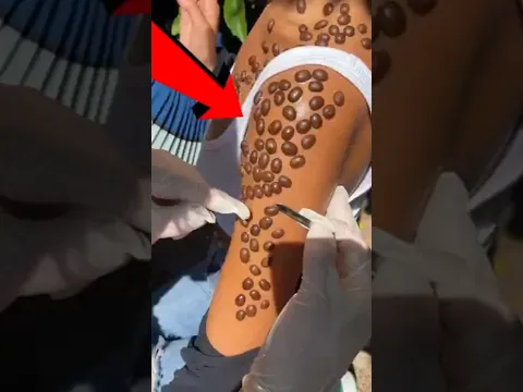 ¿Qué es esta cosa en mi hombro? 😨