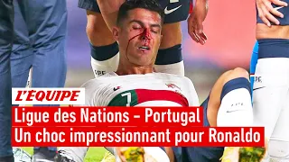 Ronaldo avec le nez en sang : les images de son choc impressionnant avec le gardien tchèque