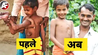 इस बच्चे के सीने में पैर है 😱 | most amazing facts | Amazing factz