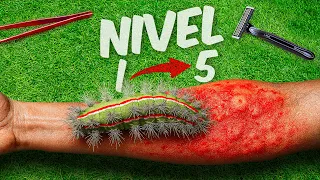 ORUGAS Nivel 1-5 ! Pierdo el Reto !