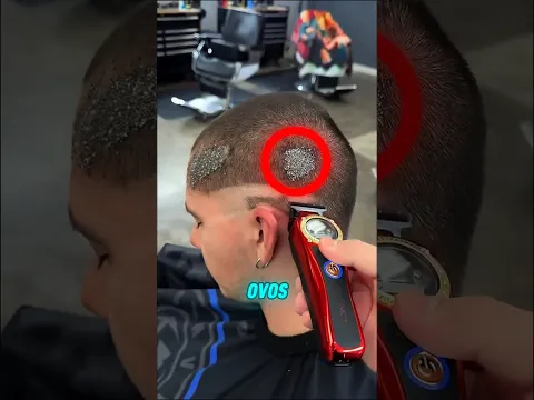 Ele foi cortar o cabelo mas tinha algo nojento na cabeça #curiosidades #shorts