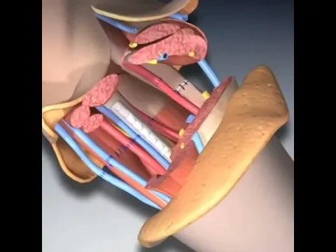 Hand transplant কিভাবে করা হয় আসুন দেখে নিই #banglahealthtips4u #shorts #ytshorts
