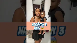 A mi hija le salen lombrices por la  Boca por comer mucho frutiño 😩😩😱😱😱😱😱