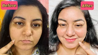 My review on Garnier Vitamin C serum | Fades darks spots in 3 days | JSuper Kaur