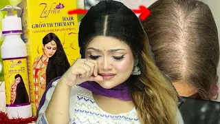 জাফরান হেয়ার অয়েল মেখে সব চুল পড়ে গেল??