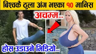 अचम्म.. बिश्वकै सबैभन्दा ठुला अँग भएका १० मानिसहरु, यति सम्म साईजका गिनिज बुकमा रेकर्ड भए ।