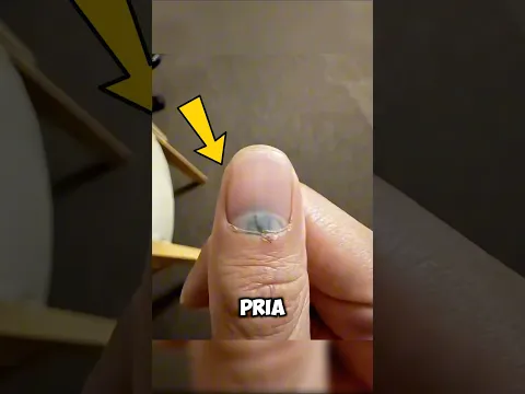 Proses Ajaib Kuku Tumbuh Kembali Setelah Terkena Palu 😲
