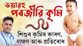 শিশুৰ কৃমিৰ কাৰণ, লক্ষণ আৰু প্ৰতিৰোধ! Dr Haris Well future