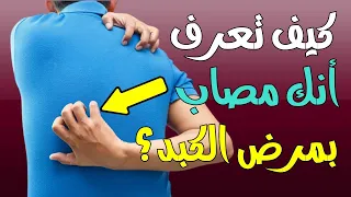 أعراض مرض الكبد - كيف تعرف أنك مصاب بمرض الكبد بعلامات تحذيرية قد لا تخطر في بال؟