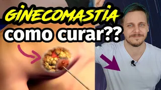 GINECOMASTIA ANTES E DEPOIS : Paciente mostrou TUDO da cirurgia, pós operatório, recuperação...