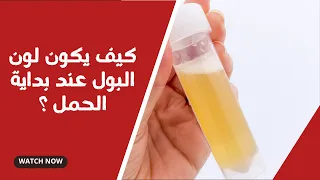 كيف يكون لون البول عند بداية الحمل ؟ وما هي علامات الحمل من البول ؟