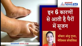 डॉक्टर ने बताया- 6 कारणों से आती है पैरों में सूजन । Health News