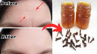 اخلطي القرنفل مع الماء  لتبدين أصغر من سنك ب10 سنوات! بوتوكس طبيعي! بالقرنفل لن تصدقي النتيجة