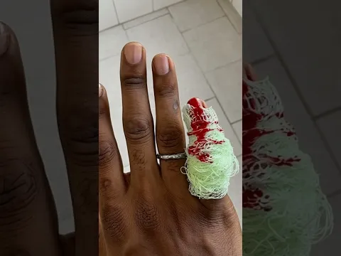 Porquê colocaram milho?