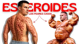 Los peores casos de Esteroides jamás vistos. (DOCUMENTAL)