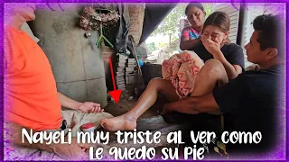 Esto le paso a Nayeli en su pie y la trajimos donde Venado. Nayeli saca el grito de Gohan