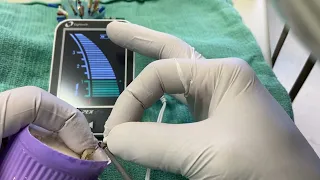 Apex Locator Tips for the General Dentist