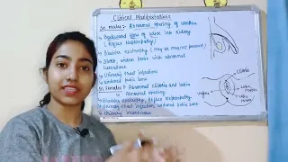 Epispadias in hindi (Penis Defect) |Causes|Symptoms|Treatment|Msn|