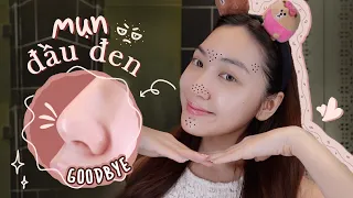 6 bước giúp xử lý mụn đầu đen, sợi bã nhờn và thu nhỏ lỗ chân lông | Chloe Nguyen