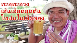 เส้นเลือดอุดตัน ไขมันในเลือดสูง ทะลุทะลวงด้วยสมุนไพร