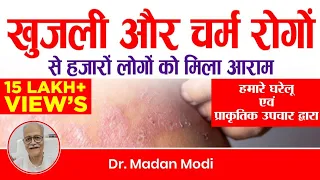 खुजली और चर्म रोगों से पीड़ितों को मिली राहत | Relief to the victims of itching and skin diseases |