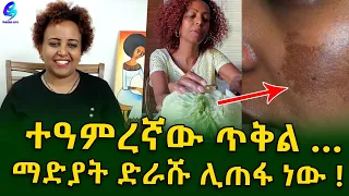 100% ማድያትን እንደሚያጠፋ እርግጠኛ ነኝ! ኤልሳ ከአሜሪካ..Ethiopia | Shegeinfo |Meseret Bezu