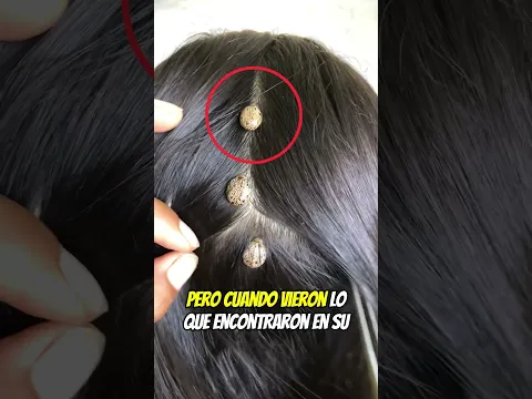 Algo salió de mi cabello 😨⚠️