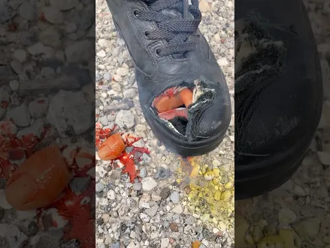 Stepped on a land mine? Try this… #war #iran #america
