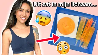 OPERATIE VLOG 💉 Borstimplantaten laten verwijderen & hoe gaat het nu? 🩸 ShelingBeauty 2021 #VLOG 3