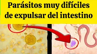 ELIMINA los PARÁSITOS de forma NATURAL 🌱 (Té de Paico, Papaya y Rábano) 🐛❌ #ParasitosIntestinales