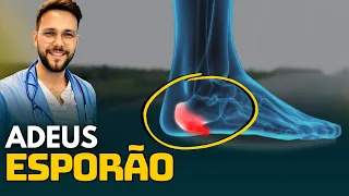 Esporão Calcâneo: Tratamento Caseiro que Realmente Funciona