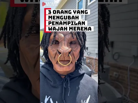 3 Orang yang mengubah penampilan wajah mereka